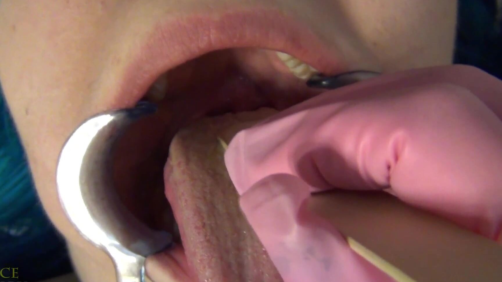 Aliceskary Dentist Probes Naughty Girls Mouth