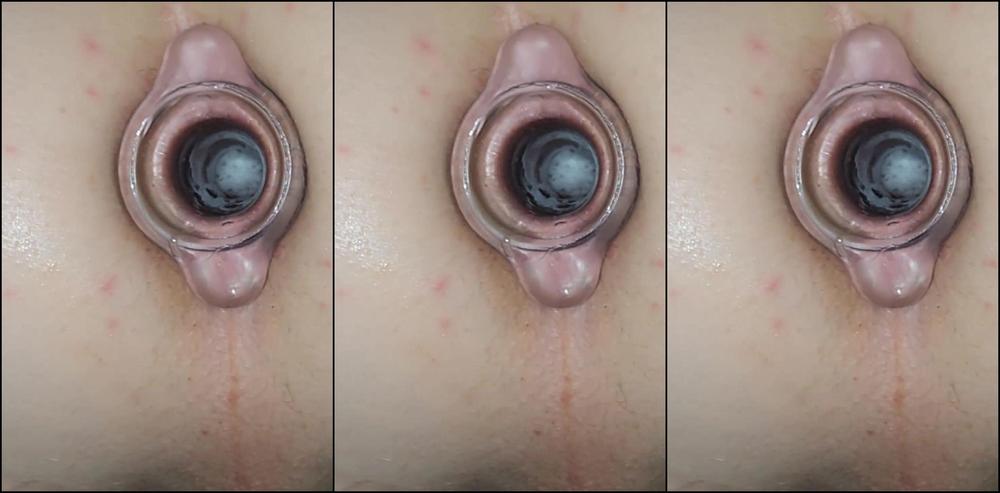 "Hung Fuckers" Anal Creampie, Cum Inside, Creampie, Filled With Cum, Ginger Anal, Ginger, Ass, Gay Big Ass Anal, Dripping Creampie, Gay Cum Filled Ass, Gay Cum Filled, Suggest Hung Fuckers MY OWN CUM IN ME Pornhub