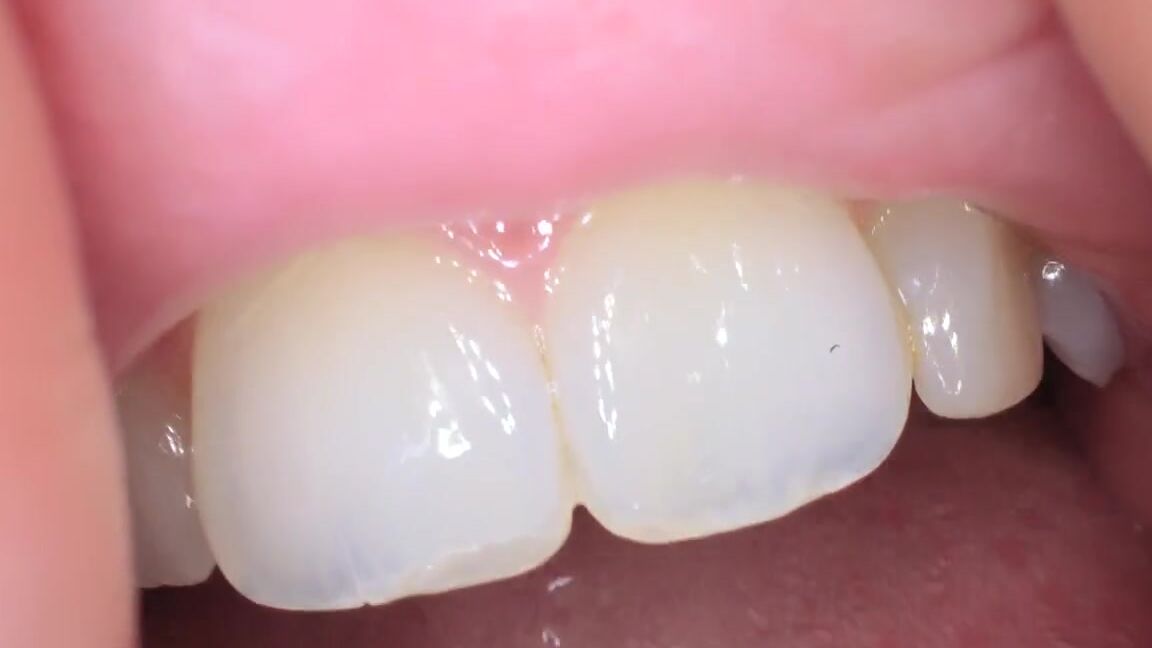 Giantess Katelyn Brooks Nicknamed Giantesskatelyn 11 28 2024 Onlyfans Video Extra Footage Drop This Is From My Girlfriend And I Will Fuck You If You Make