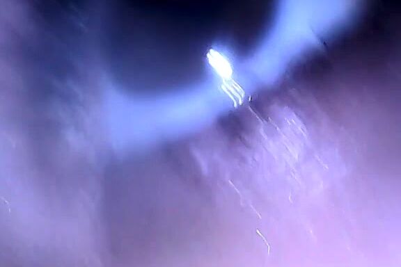 Amber Fun Eye Fetish Video With Scope Cam