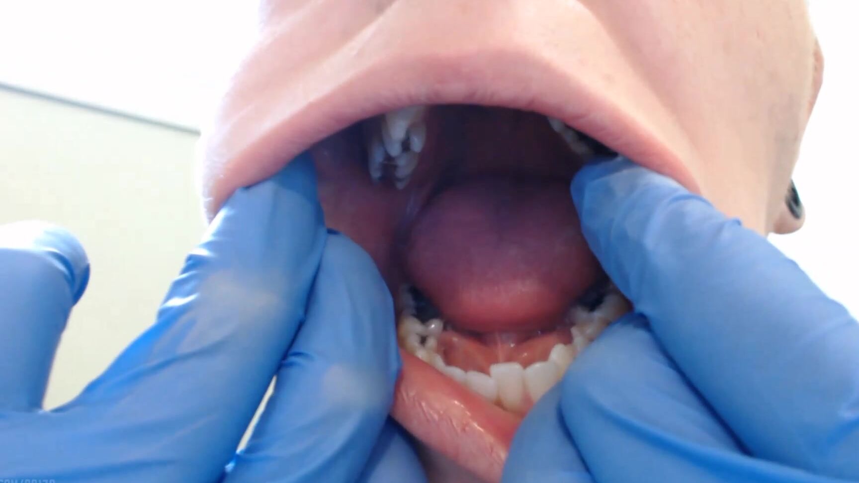 Booty U Medical Gloves Examine My Mouth