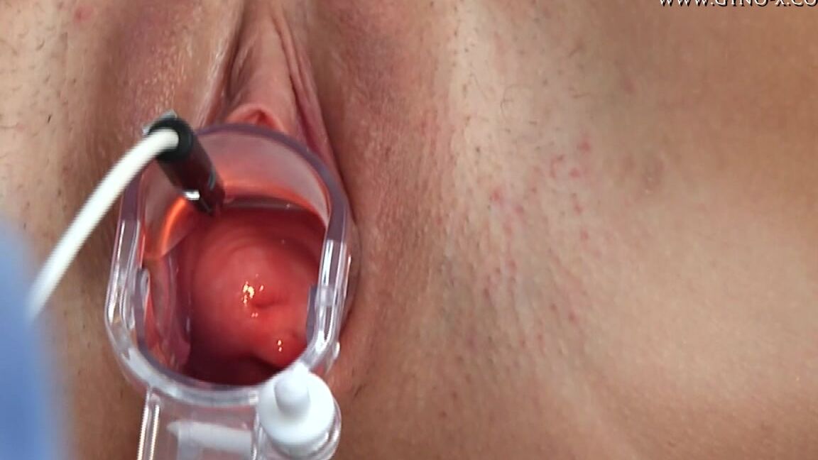 Frida Gyno Exam_2 SiteRip