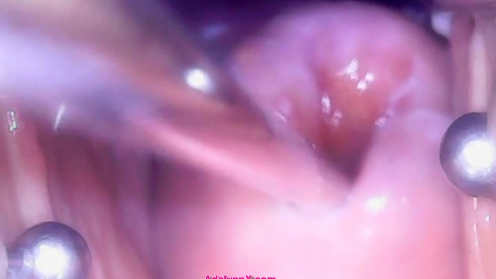 Extreme Close-ups, Kink, Medical Fetish, MILF, Sounding adalynnx look into my womb endoscope in cervix ManyVids