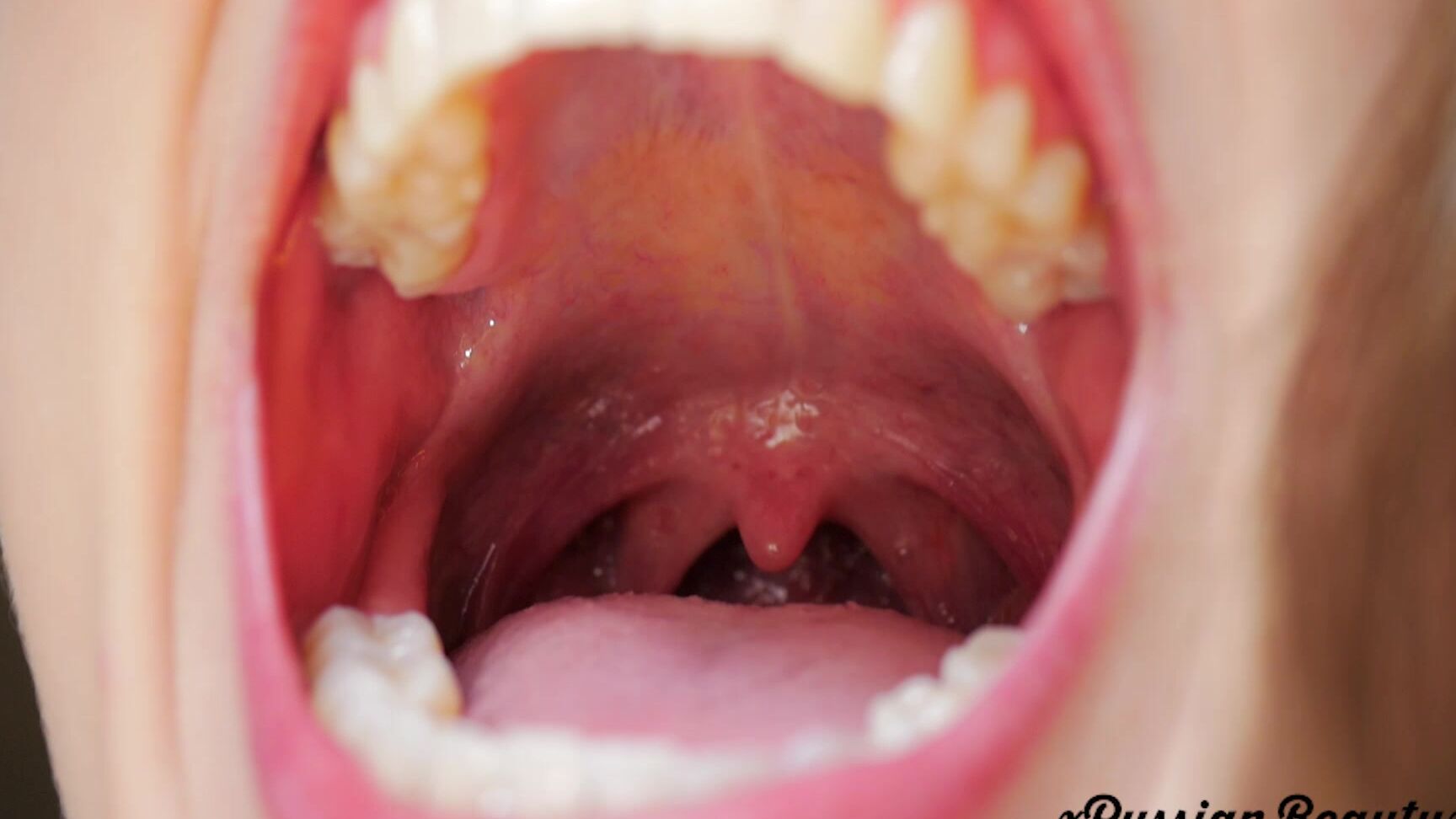 Coughing Fetish, Mouth Fetish, Throat Fetish, Tongue Fetish, Uvula Fetish madison marz mouth and uvula fetish ManyVids