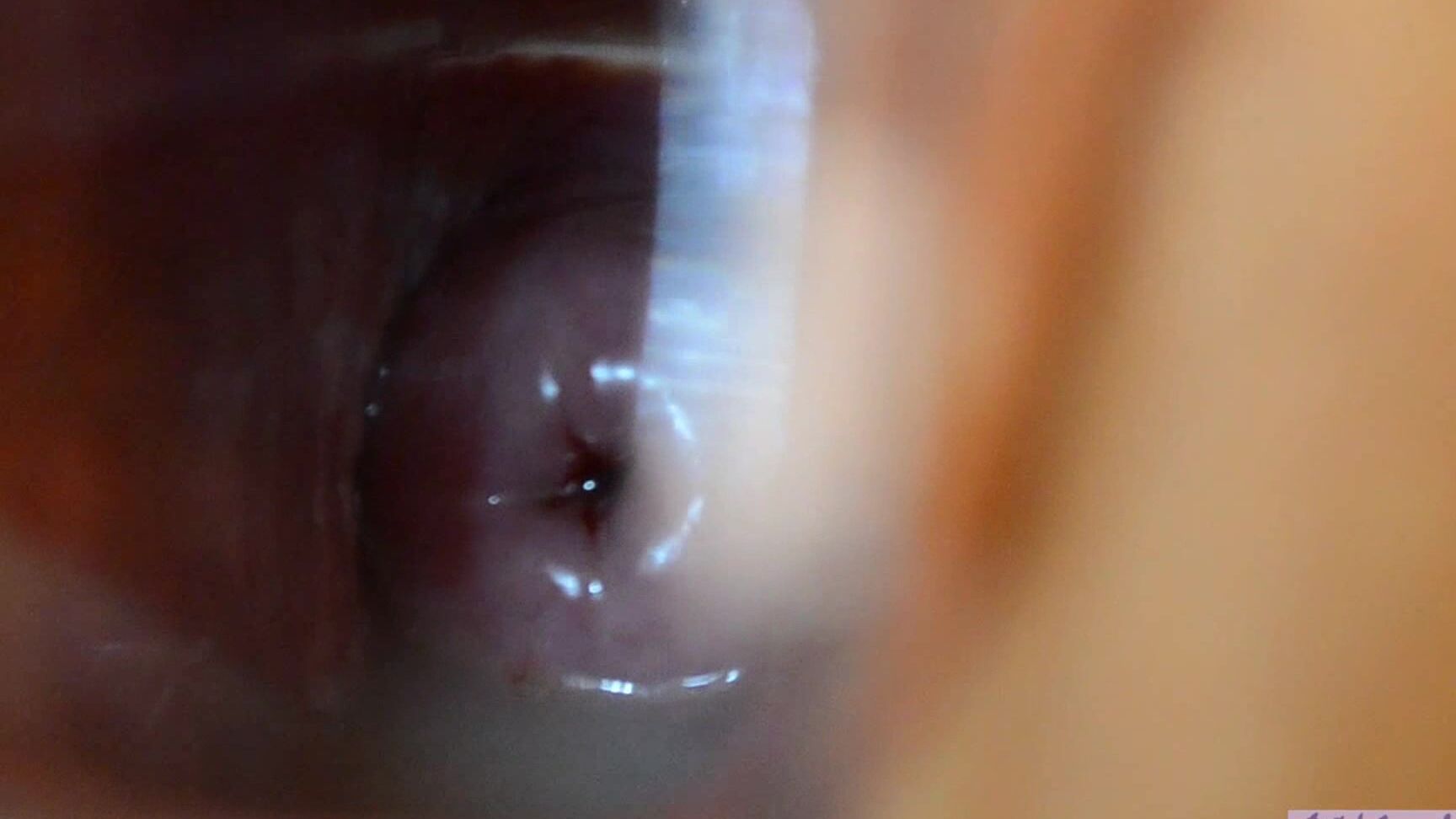 Anjee Lowe Sperm Speculum