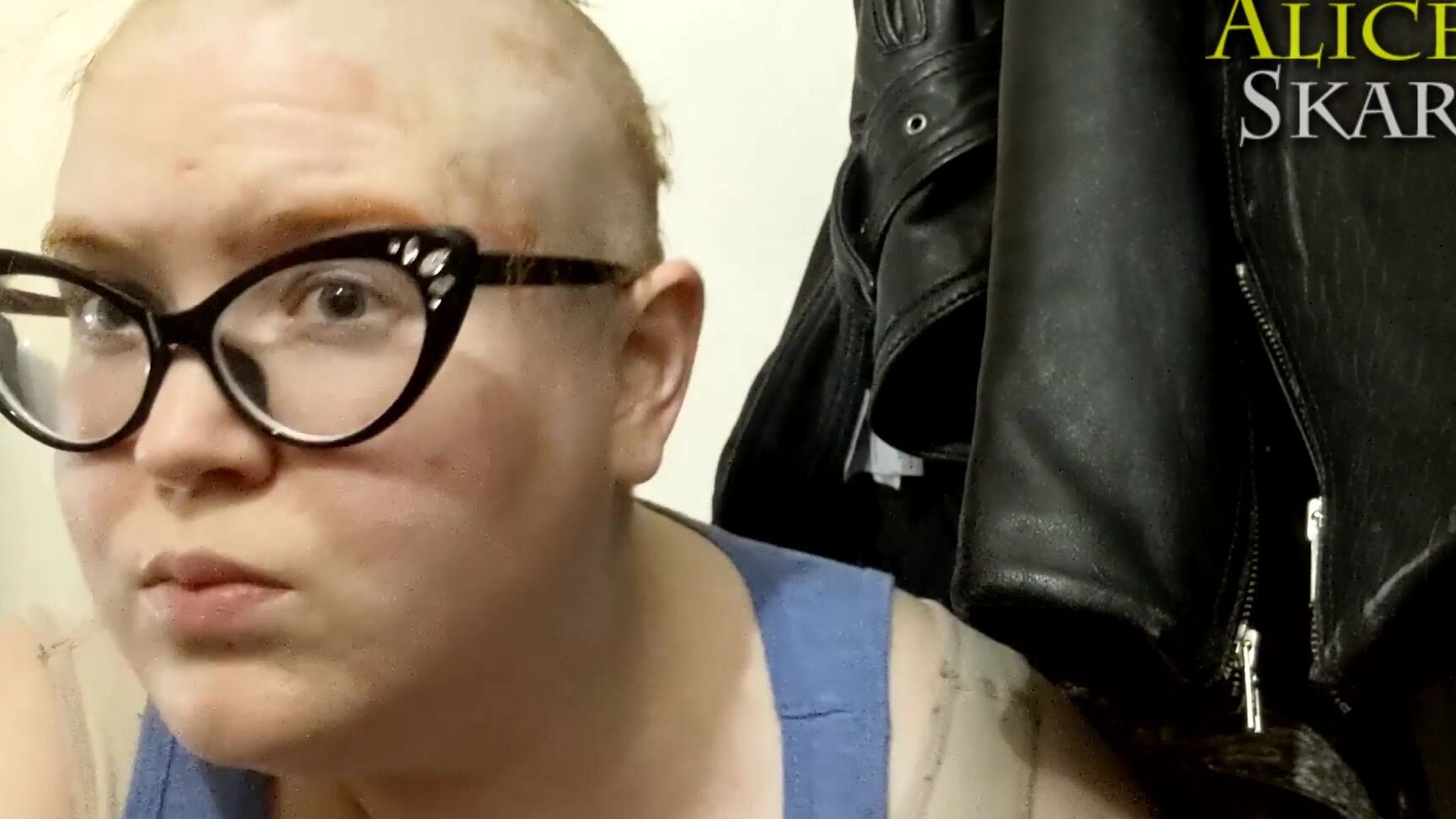 Aliceskary Spontaneous Head Shaving While Sick