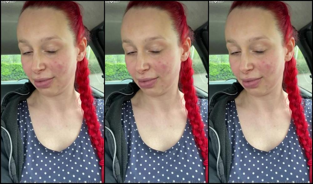 Mfetilicious I Want To Share This Little Video With You About My Last Experience With Fillers And Botox