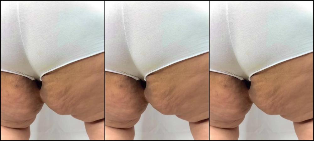 Nikkixvalentine 3069680073 08 22 2024 How Are My Stripping Skills