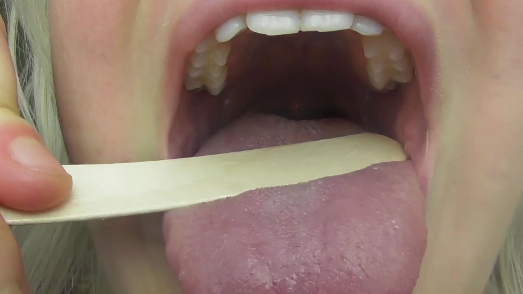 "Fake Hospital" Kink, Uvula, Uvula Fetish, Girl Uvula, Mouth Uvula, Mouth Fetish, Throat Fetish, Mouth, Uvula Inspection, Uvula Play, Uvula Throat, Uvula Pov, Deep Mouth, Back Of Throat, Suggest Fake Hospital Uvula Compilation Mouth Fetish pornhub