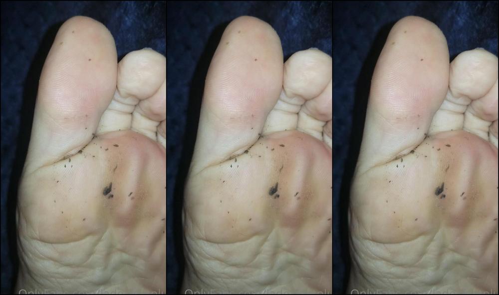 Jadezfeetplus 2264170662 11 03 2021 Today S Toe Jam Is Crazy I Want You To Go Get That Jar Of Toe Jam