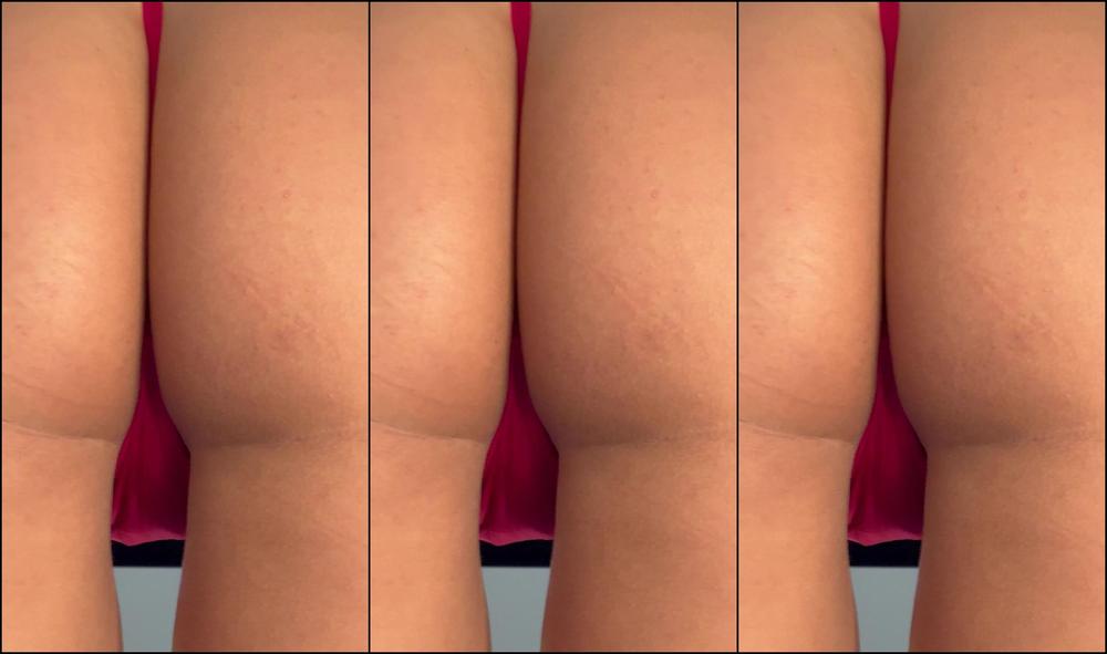 Belllexox 3579183887 11 25 2024 Put Your Face Right In It Would You