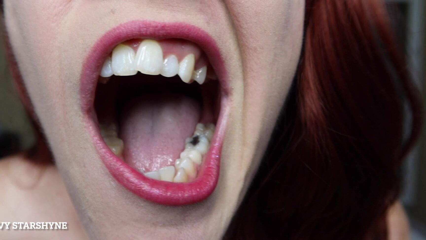 Ivystarshyne Mouth Update