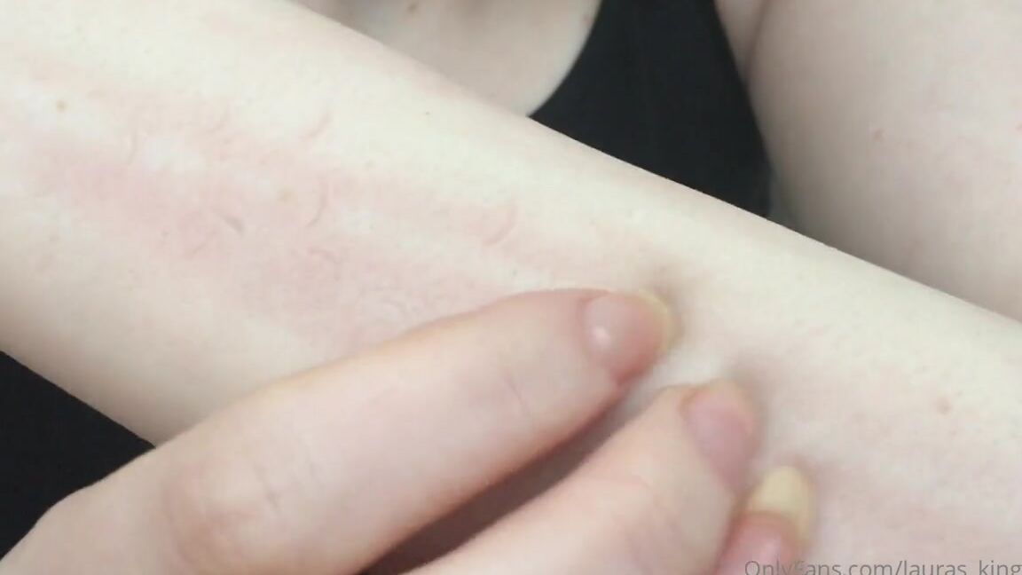 Lalalaura Nicknamed Lauras Kingdom 08 26 2024 Onlyfans Video Olivia Arm Scratch