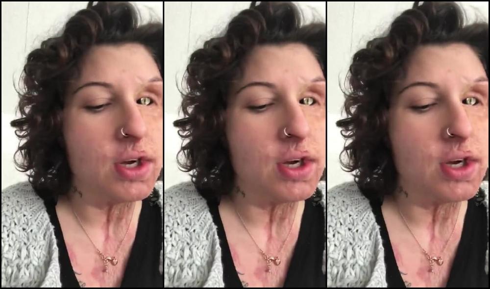 Beauty with Fake Eye 2_ampfan2003 PornHub