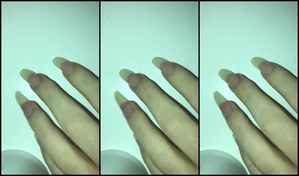 Lalalaura Nicknamed Lauras Kingdom 08 01 2024 Onlyfans Video Mira Apple Claw