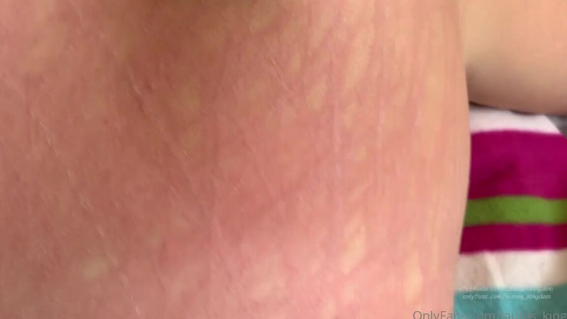 Lalalaura Nicknamed Lauras Kingdom 01 20 2021 Onlyfans Video Chillas Hard Slave Scratch Chilla Is Back In This Video She Scratches Her Slaves Back Hard