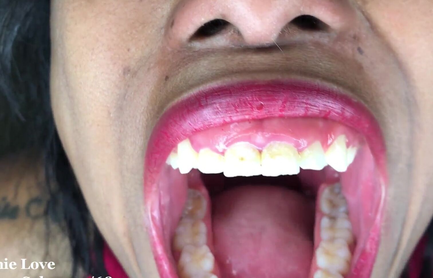 Lanie Love Endoscope Time