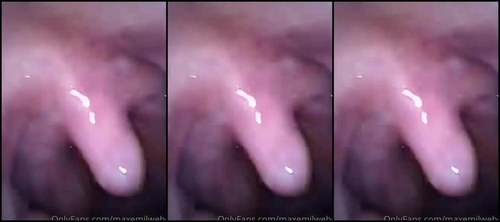 Emily Maxemilweber Nicknamed Maxemilweber 11 01 2020 Onlyfans Video Endscope Part2 Pw