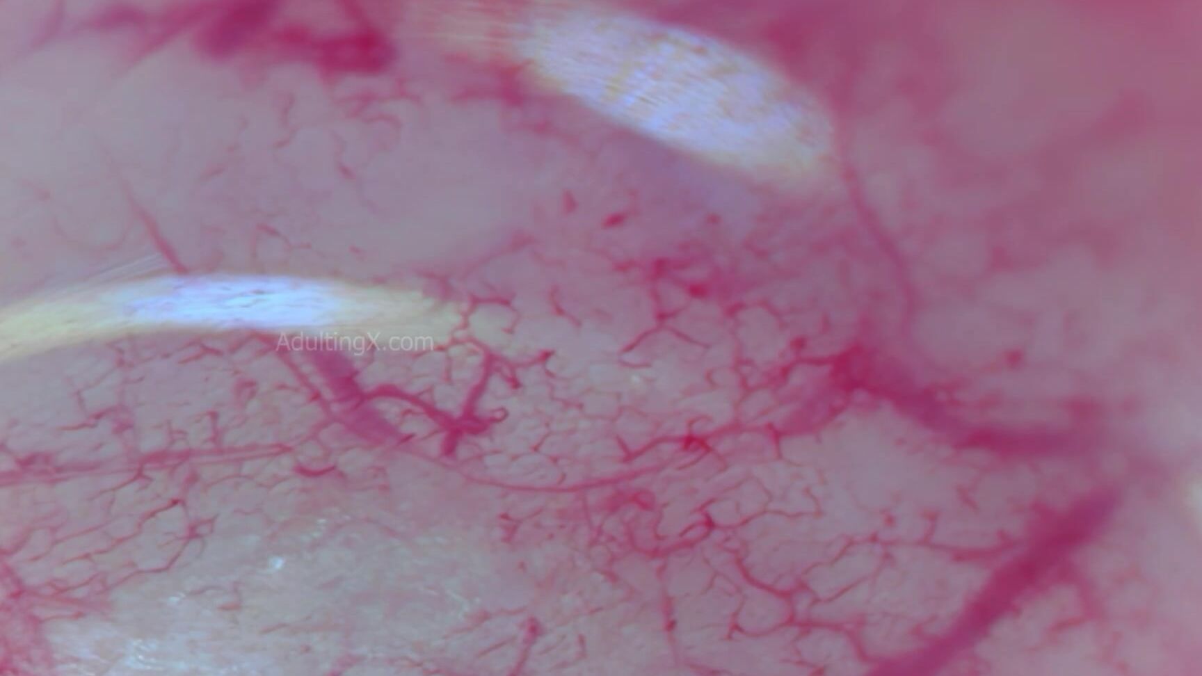 "Adulting" Anal, Camera Inside Anal, Camera Inside Ass, Anal Orgasm, Female Heartbeat, Endoscope, Giantess, Vore, Gyno, Medical, Throbbing, Authentic, Female Orgasm Real, Close Up Extreme, Asmr, Suggest Adulting Camera Inside Ass 9 Throbbing Pulsing 