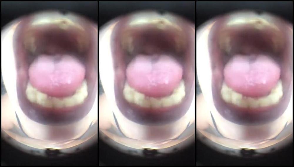 Katlyn Moree Nicknamed Katlynmoree Onlyfans Purple Lips Shouting At Small