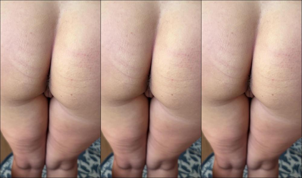 Diet Marshmallow 241