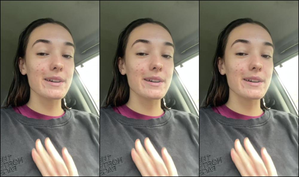 Cheekymz 28060097 03Bb 4Cb0 A262 Bd27D2A45Fb5 Mlh8Nhsb