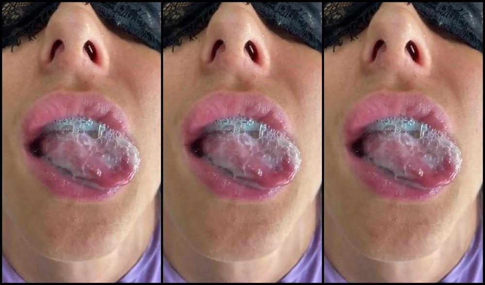 Froggeevip Onlyfans Cum Play Braces Lovers Enjoy