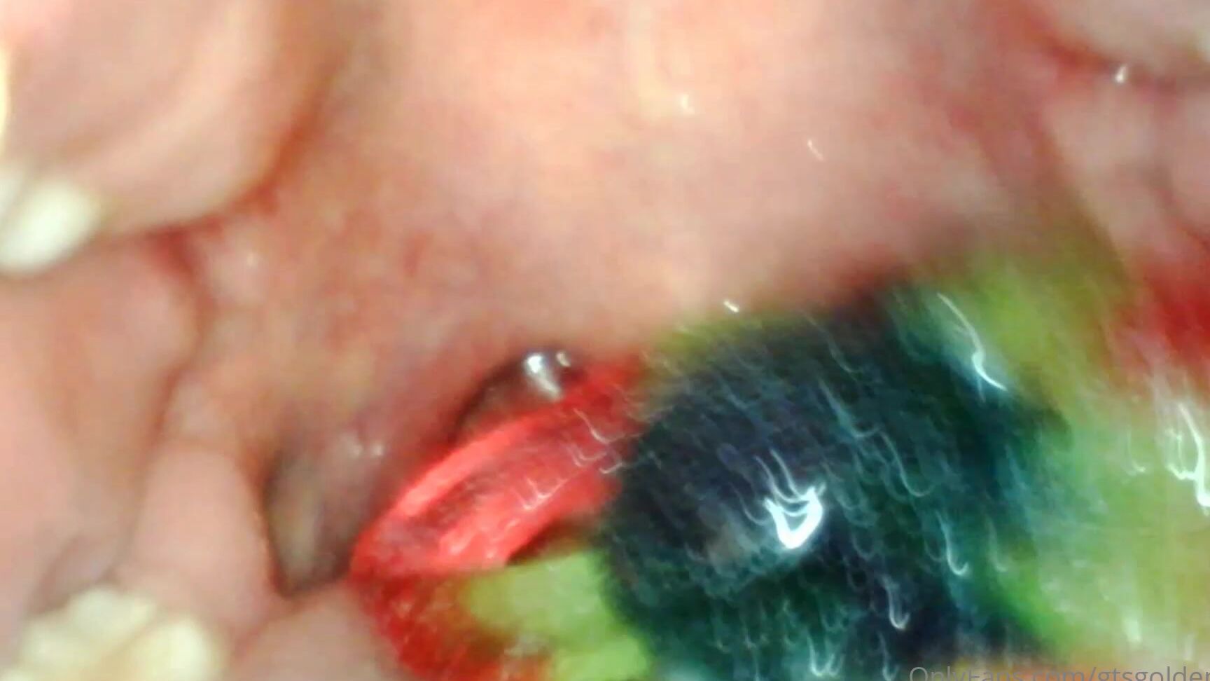 Gtsgoldenlace Endo Cam Gummy Swallow