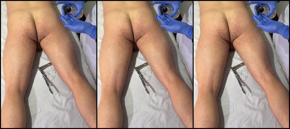 Milking Nurse Nicknamed Milking Nurse 11 25 2024 Onlyfans Video Just A Little Anal Exam To Test Your Sphincters Ability To Adapt To Different Sizes And 5