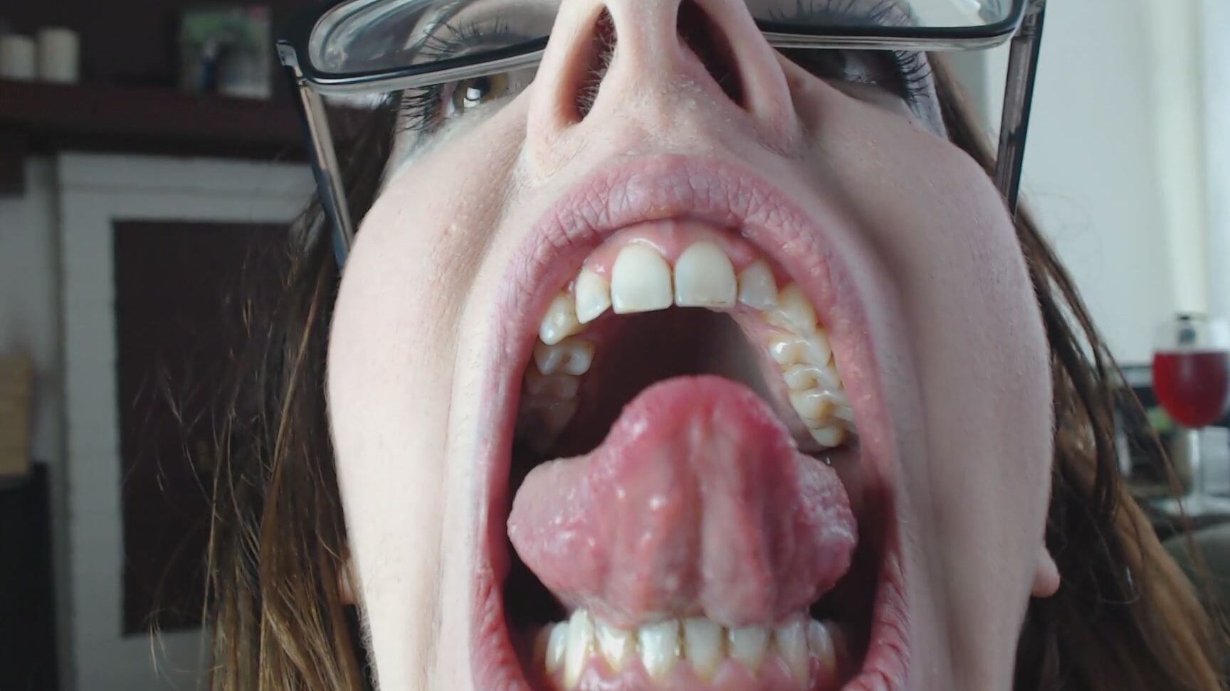 Canadiansammy Roof Of Mouth Upper Teeth Hard Palate