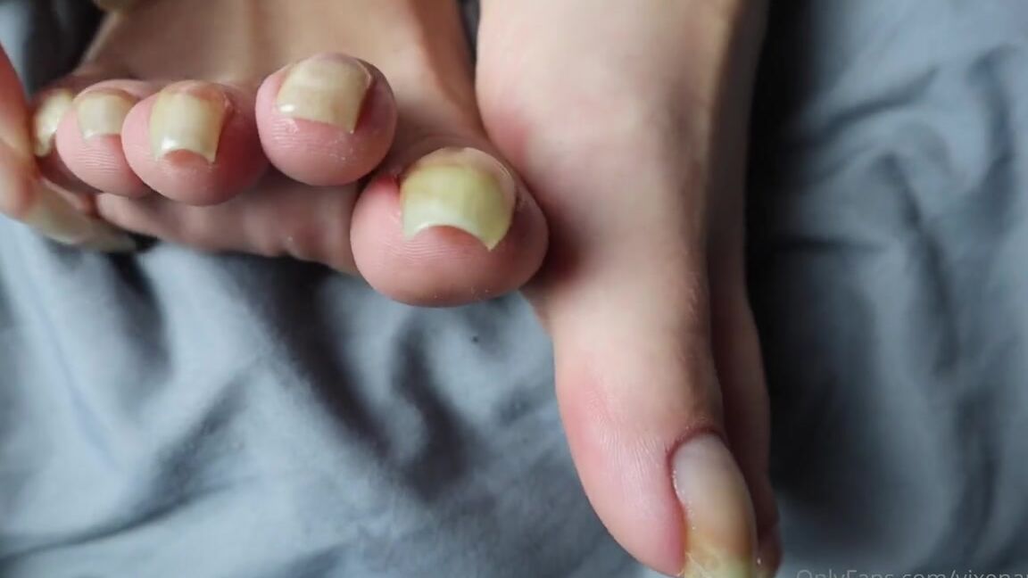 Vixenarches Onlyfans Measuring My Bare Toenails At Their Longest Ever Record Length 4K Video