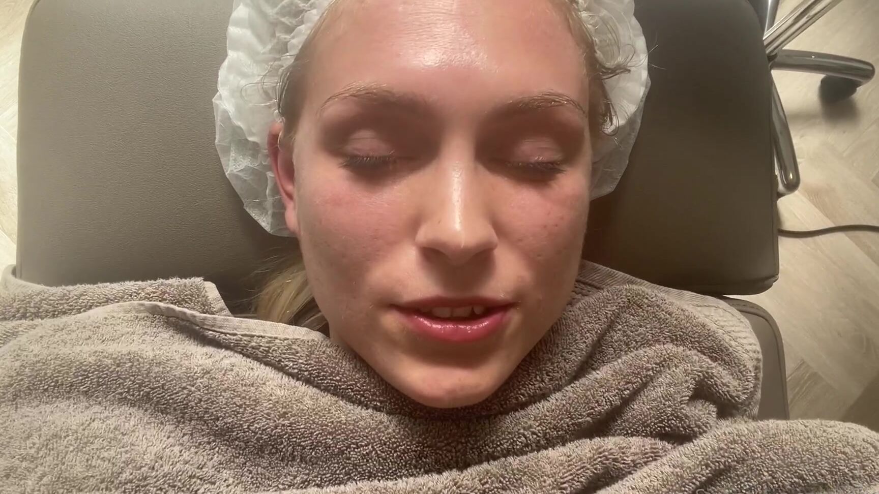 Siswet Face Peeling Day Lol It S Gonna Look Terrible