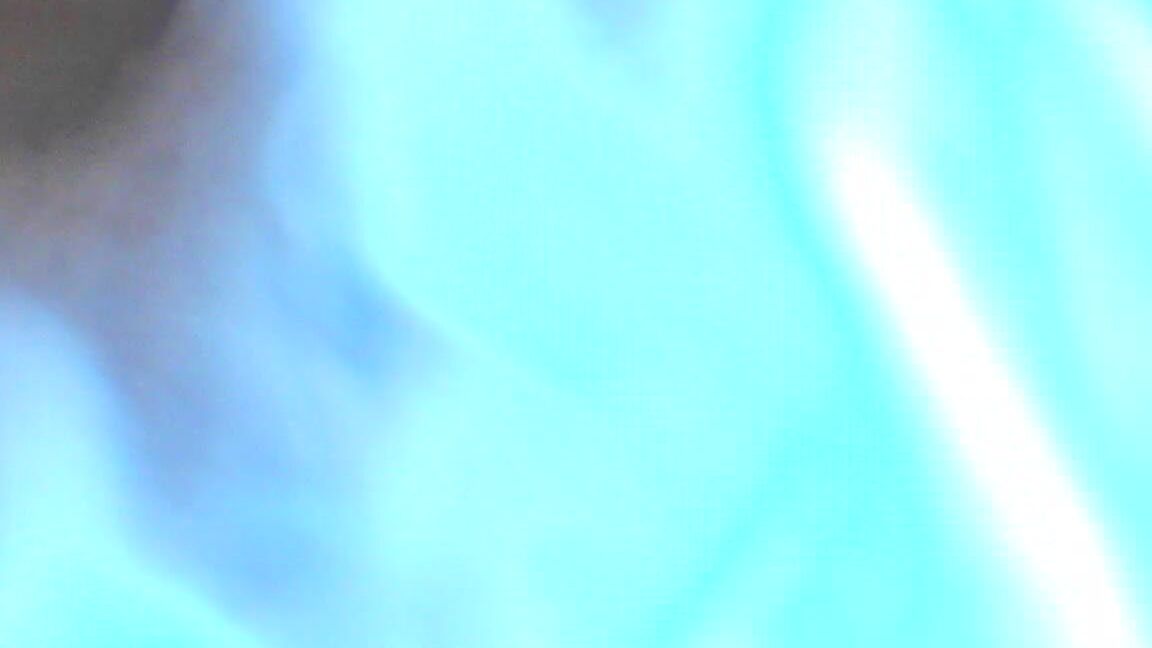 Milly Gapig Pussy Endoscope Exploration