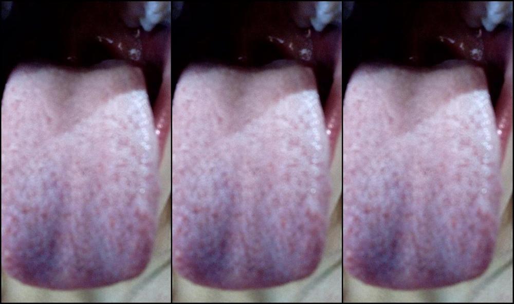 Twowolvesxxx Open Mouth