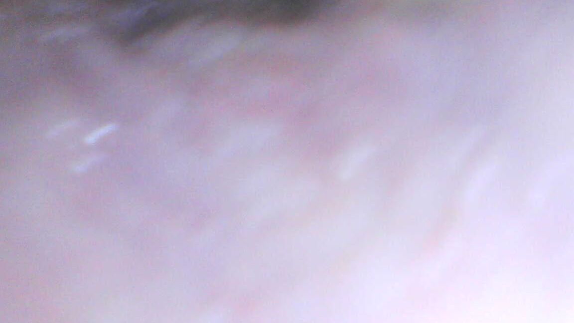 Milly Endoscope Play Part