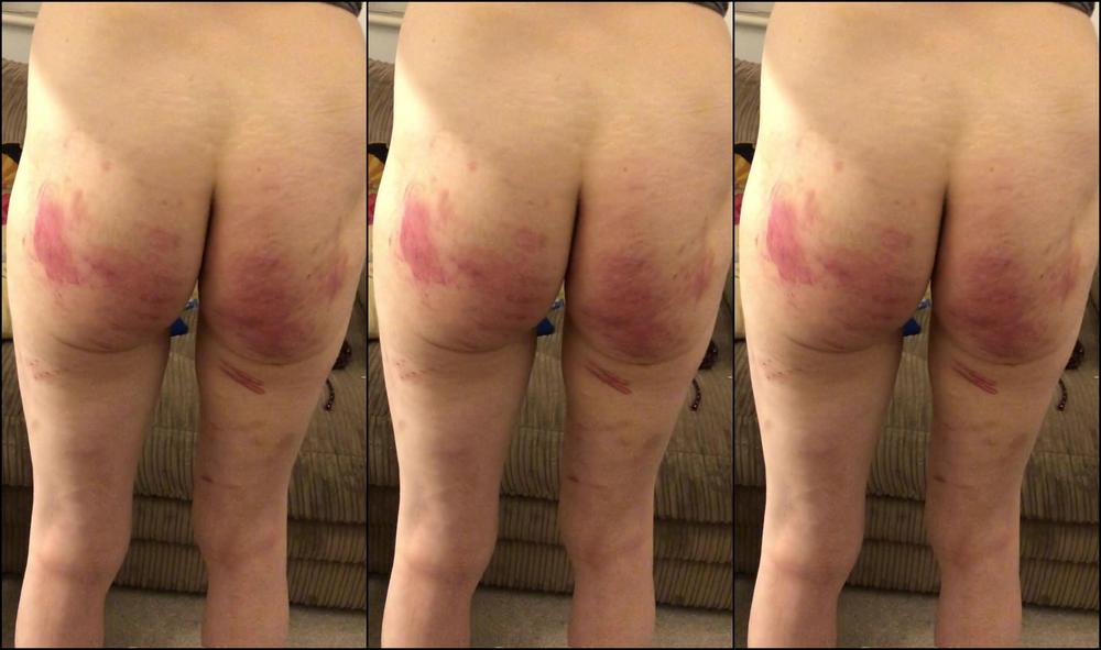 Miss Ruby Marks Such A Naughty Girl Just Look At All Those Marks But She Is Al