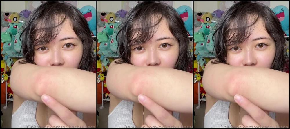 Erikasbulbasaur Nicknamed Erikasbulbasaur Onlyfans Count My Bug Bites With Me I Shoulda Done This Last Time I Came To Az I Had Waaaaayy More Haha M 1