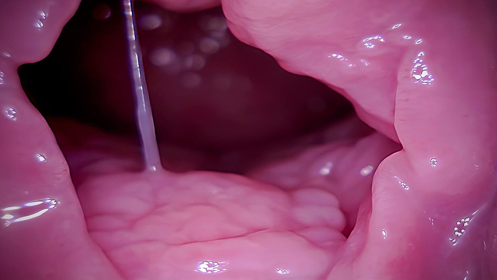 Adulting Cervix, Vore, Giantess, ASMR Pornhub