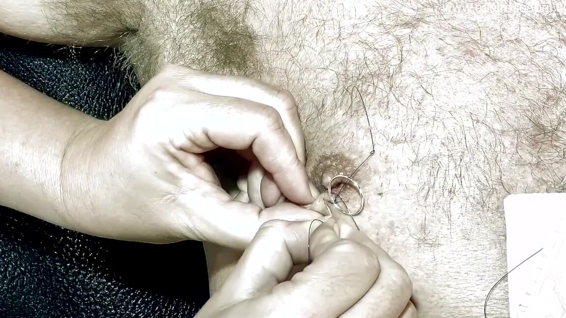 Dominaytix Mistress April Medical Chastation By Dominatrix