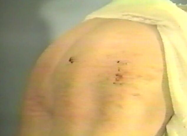 "Mix" BDSM The birching of Bernadette o Neil Nu-West