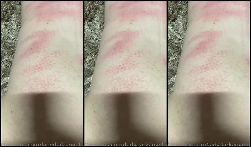Ladydarkangeluk Onlyfans Good Morning Who Can Tell Me What Has Made These Gorgeous Marks Love Leaving My Mark Fir You To Tak