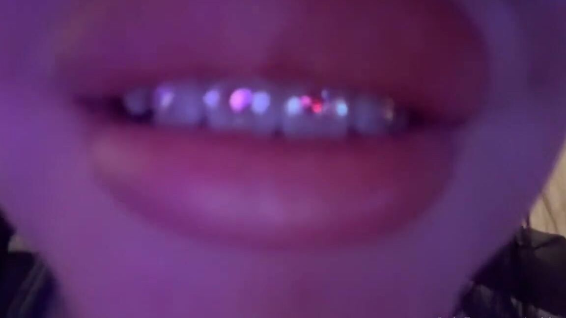 Ang3L Nicknamed Ashhang3L 02 10 2025 Onlyfans Video Its So Fucked Up Getting Hard For Braces