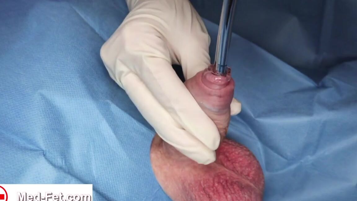 Latex Nurse Gives Sounding Catheterisation And Anal Dilation With Dildo And Multiple Sample Collection