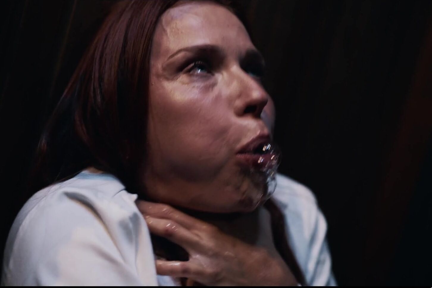 Milan Cheek Parasited Cure