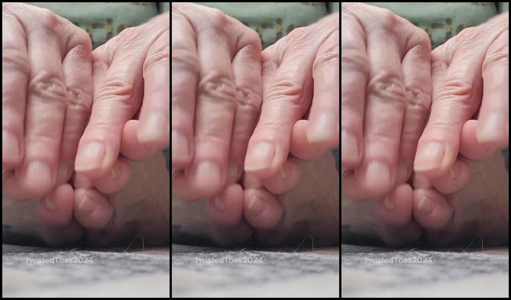 Twisted Toes Nicknamed Twistedtoes Foot Fetish 01 11 2024 Onlyfans Video Watch Me Moisturize My Feet