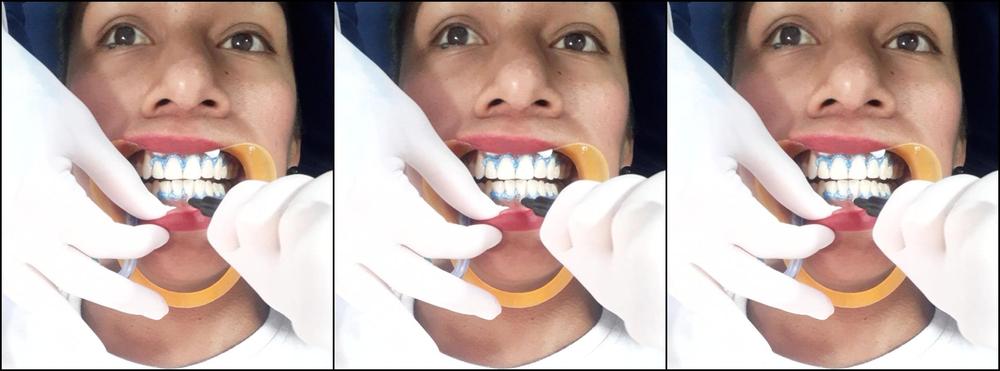 "Lola bbunny" 7rings, abs, accent, dentist, fetish fetish dentist Manyvids