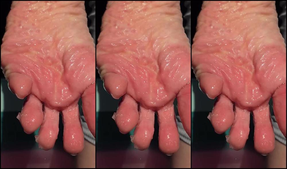 Joyfullfeet Nicknamed Joyfullfeet 09 14 2024 Onlyfans Video Jelly Spa Soak Before Beginning The Peeling Process Of My Feet